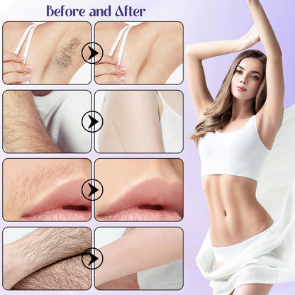ROSINO Coconut Oil Facial Hair Removal Cream for Women – Gentle Depilatory Cream for Smooth, Hair-Free Skin (1 oz) Avelisse