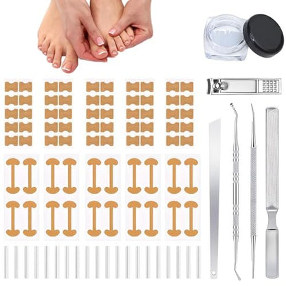 Professional Ingrown Toenail Set with Breathable Strips, Curved Toenail Corrector, Painless File & Lifter - BSolus Avelisse