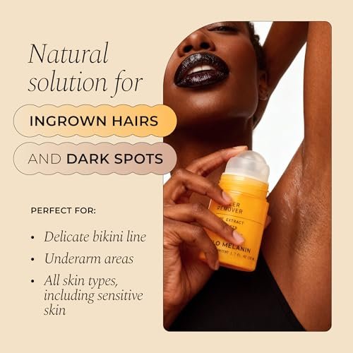 Glo Melanin Dark Spot Topical Roll-On – 1.7 fl oz – Targeted Brightening for Inner Thighs & Underarms with Kojic Acid, Licorice & Willow Bark – Vegan & Paraben-Free Avelisse
