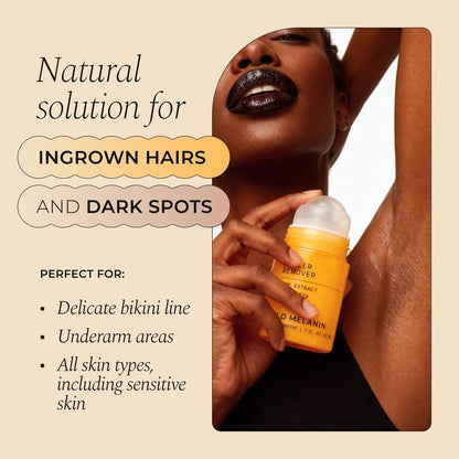 Glo Melanin Dark Spot Topical Roll-On – 1.7 fl oz – Targeted Brightening for Inner Thighs & Underarms with Kojic Acid, Licorice & Willow Bark – Vegan & Paraben-Free Avelisse