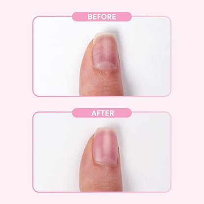 Orly Nail Retouch Smooth & Blur Effect for Nails | Nail Treatment + Nail Color Hybrid | Airbrush Effect for Nails (Yellow, 2 Fl Oz)
