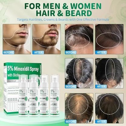 5% Minoxidil Spray for Hair Growth, 4 Pack (8.12oz), For Men & Women – Extra Strength Hair Regrowth Treatment with Biotin & Castor Oil, Supports Thicker Fuller Hair & Beard, Non-Greasy 4-Month Supply Avelisse