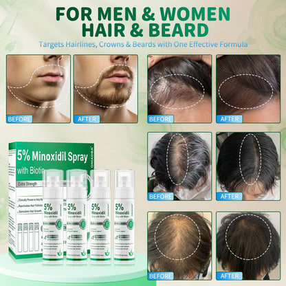 5% Minoxidil Spray for Hair Growth, 4 Pack (8.12oz), For Men & Women – Extra Strength Hair Regrowth Treatment with Biotin & Castor Oil, Supports Thicker Fuller Hair & Beard, Non-Greasy 4-Month Supply Avelisse