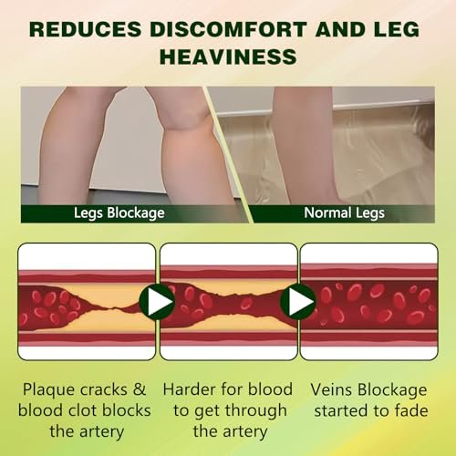 FluidEase Leg Therapy Edema Cream - Natural Herbal Relief for Swollen Legs and Feet, 1 Fl Oz Avelisse
