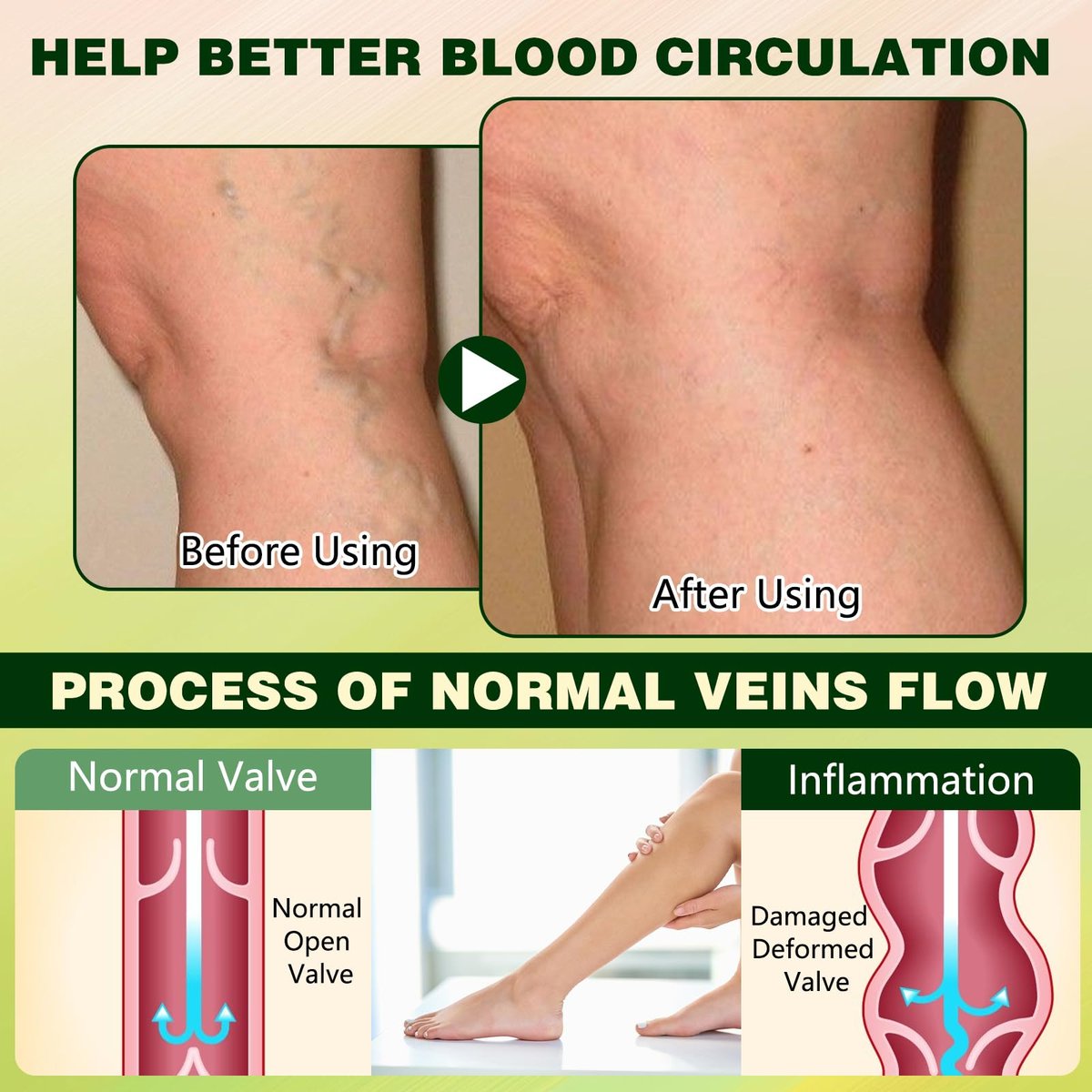 FluidEase Leg Therapy Edema Cream - Natural Herbal Relief for Swollen Legs and Feet, 1 Fl Oz Avelisse
