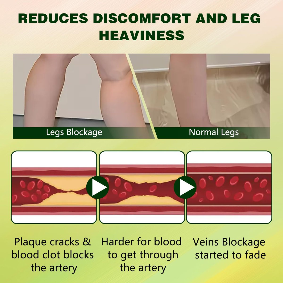 FluidEase Leg Therapy Edema Cream - Natural Herbal Relief for Swollen Legs and Feet, 1 Fl Oz Avelisse