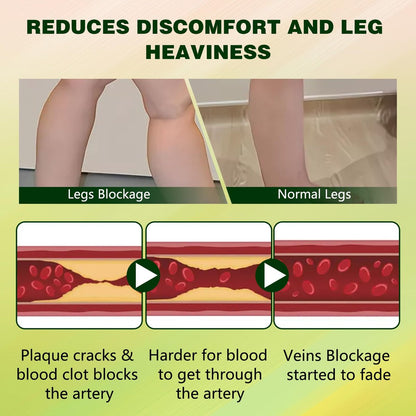 FluidEase Leg Therapy Edema Cream - Natural Herbal Relief for Swollen Legs and Feet, 1 Fl Oz Avelisse
