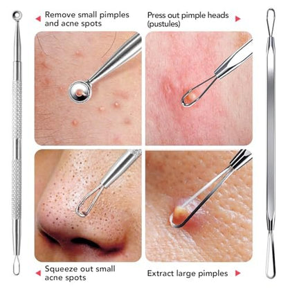Litbear 6-Piece Stainless Steel Blackhead Remover Tool Kit with Leather Case – Pimple Popper & Acne Extractor for Deep Cleansing