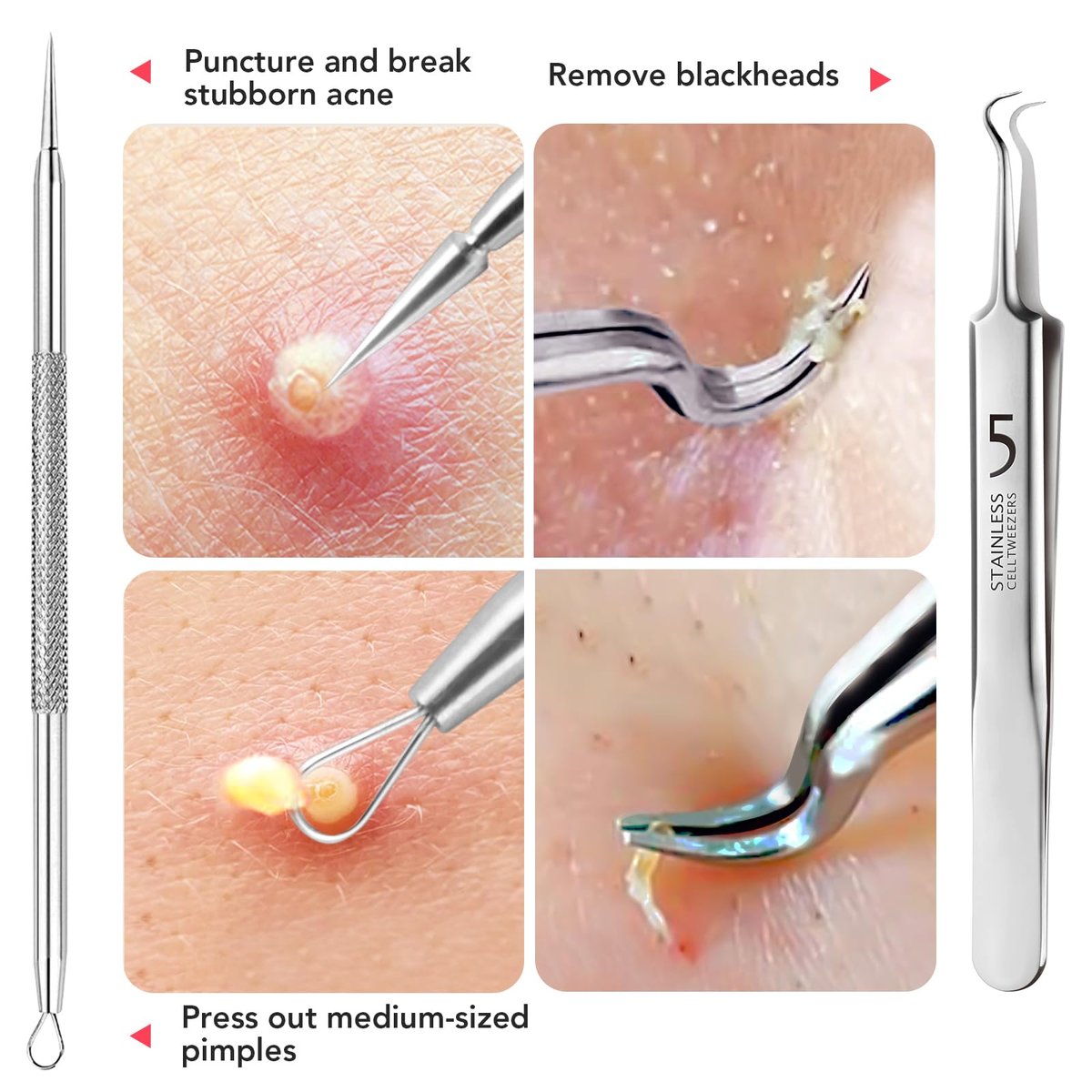 Litbear 6-Piece Stainless Steel Blackhead Remover Tool Kit with Leather Case – Pimple Popper & Acne Extractor for Deep Cleansing - görsel 9