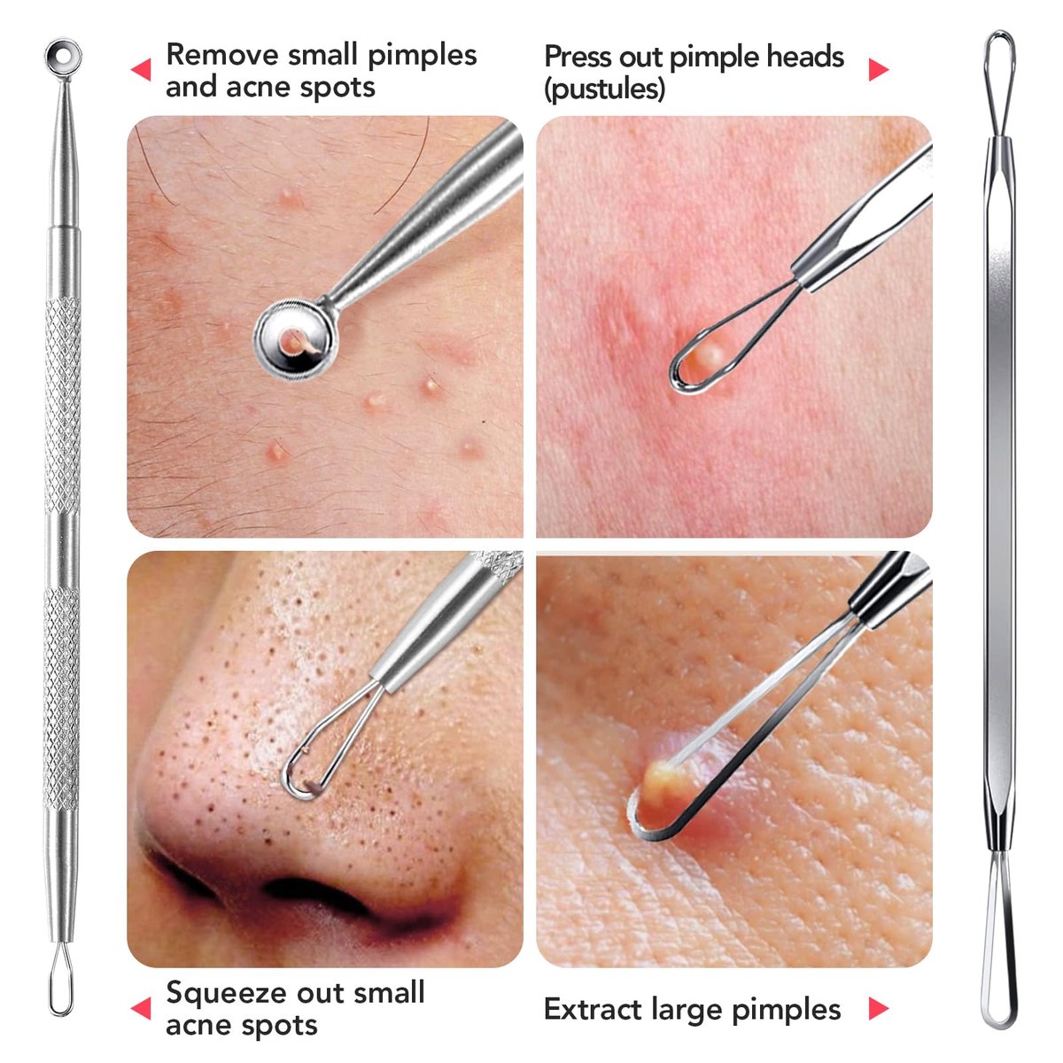 Litbear 6-Piece Stainless Steel Blackhead Remover Tool Kit with Leather Case – Pimple Popper & Acne Extractor for Deep Cleansing - görsel 11