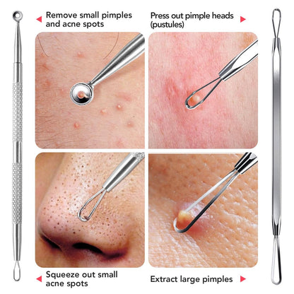 Litbear 6-Piece Stainless Steel Blackhead Remover Tool Kit with Leather Case – Pimple Popper & Acne Extractor for Deep Cleansing