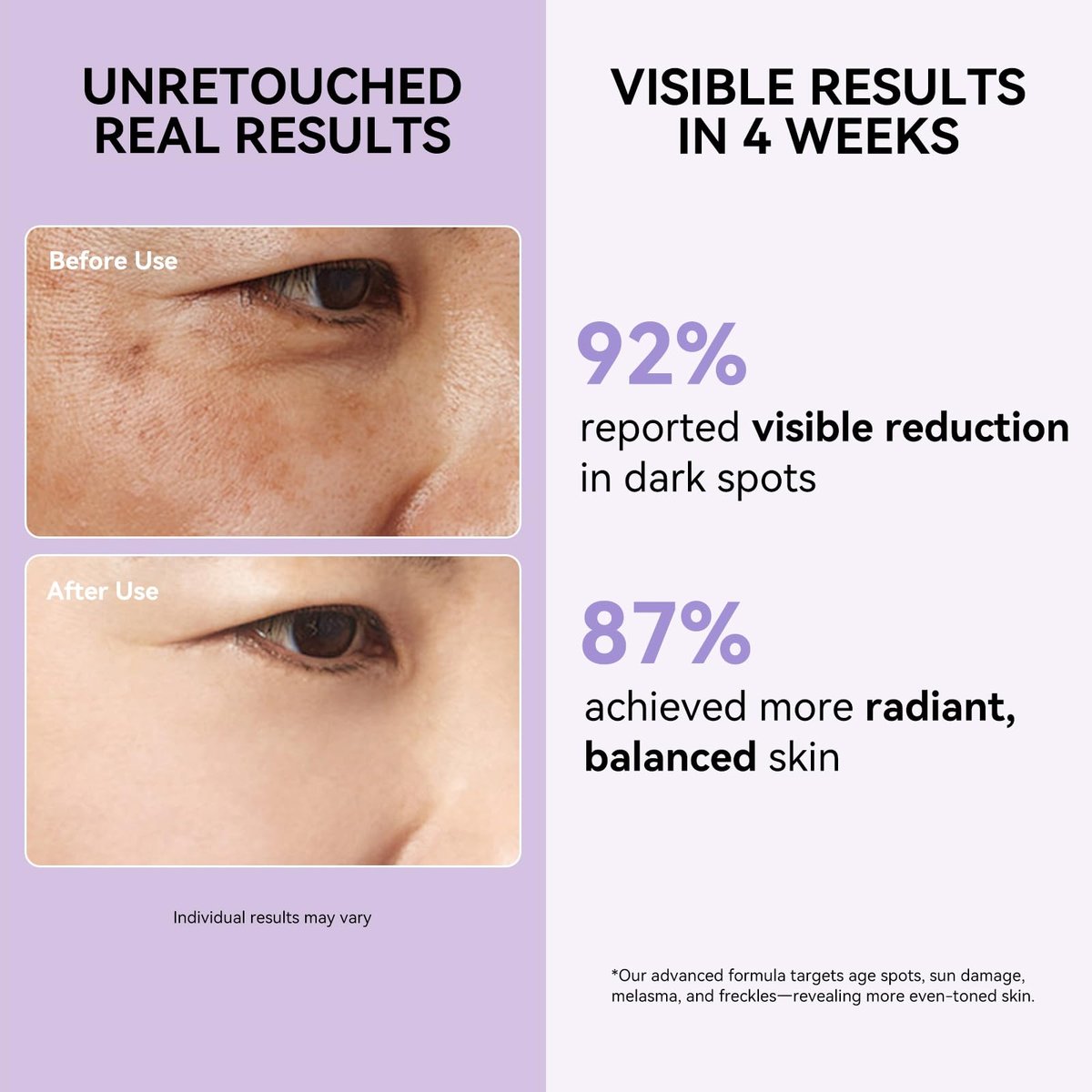 Dark Spot Remover for Face and Body - Dark Spot Corrector Serum for Sun Spots, Age Spots, Brown Spots, Freckles & Melasma - Skin Care Repair Evens Skin Tone for All Skin Types 1.7 Fl Oz Avelisse