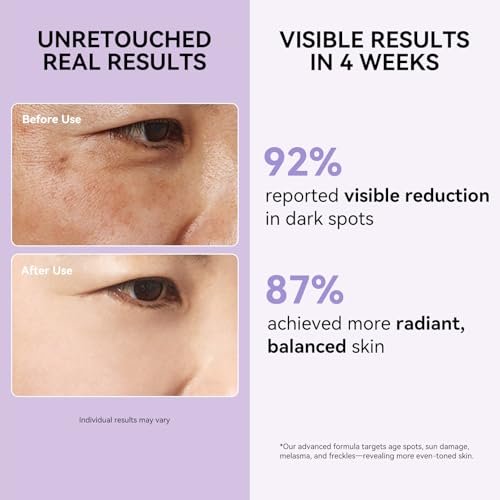 Dark Spot Remover for Face and Body - Dark Spot Corrector Serum for Sun Spots, Age Spots, Brown Spots, Freckles & Melasma - Skin Care Repair Evens Skin Tone for All Skin Types 1.7 Fl Oz Avelisse