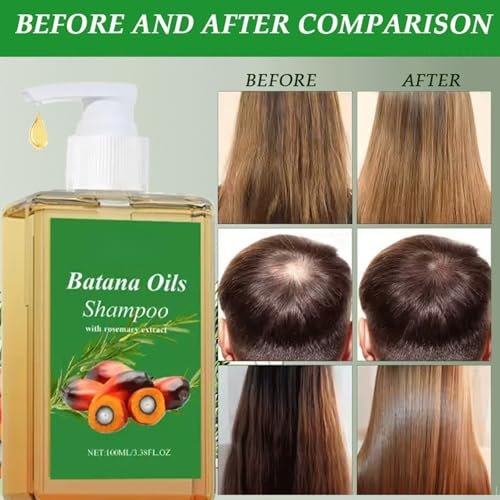 2-Pack Batana Oil & Rosemary Oil Shampoo for Hair Growth, Nourishing & Regenerating Shampoo for Men & Women - görsel 10