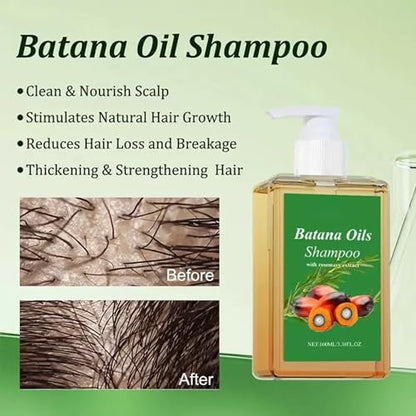 2-Pack Batana Oil & Rosemary Oil Shampoo for Hair Growth, Nourishing & Regenerating Shampoo for Men & Women
