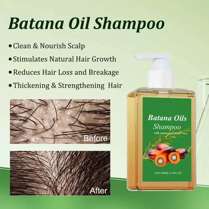 2-Pack Batana Oil & Rosemary Oil Shampoo for Hair Growth, Nourishing & Regenerating Shampoo for Men & Women