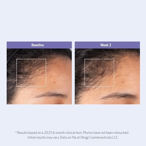 Obagi Nu-Cil BioStim Hair Scalp Serum with Biotin – Clinically Proven for Scalp Health, Fuller & Denser Hair – Lightweight Formula Strengthens Follicles & Encourages Regrowth – 2 oz Avelisse