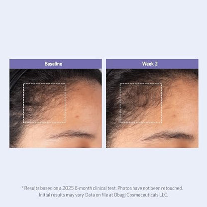 Obagi Nu-Cil BioStim Hair Scalp Serum with Biotin – Clinically Proven for Scalp Health, Fuller & Denser Hair – Lightweight Formula Strengthens Follicles & Encourages Regrowth – 2 oz Avelisse