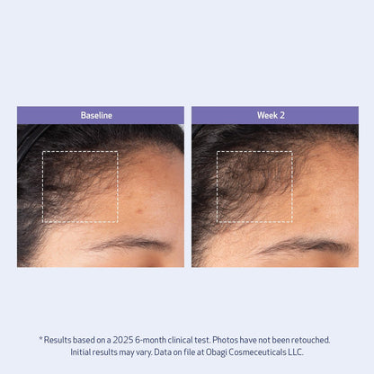 Obagi Nu-Cil BioStim Hair Scalp Serum with Biotin – Clinically Proven for Scalp Health, Fuller & Denser Hair – Lightweight Formula Strengthens Follicles & Encourages Regrowth – 2 oz Avelisse