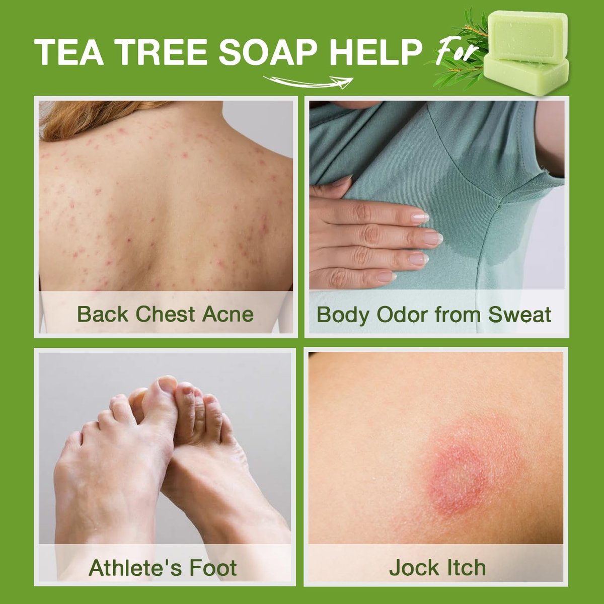 PHARMBANNER Tea Tree Antifungal Soap Bar – 2-Pack, 4.1 oz Each – Body Wash for Acne, Folliculitis, Jock Itch, Ringworm, Athlete’s Foot, Body Odor & Eczema Avelisse