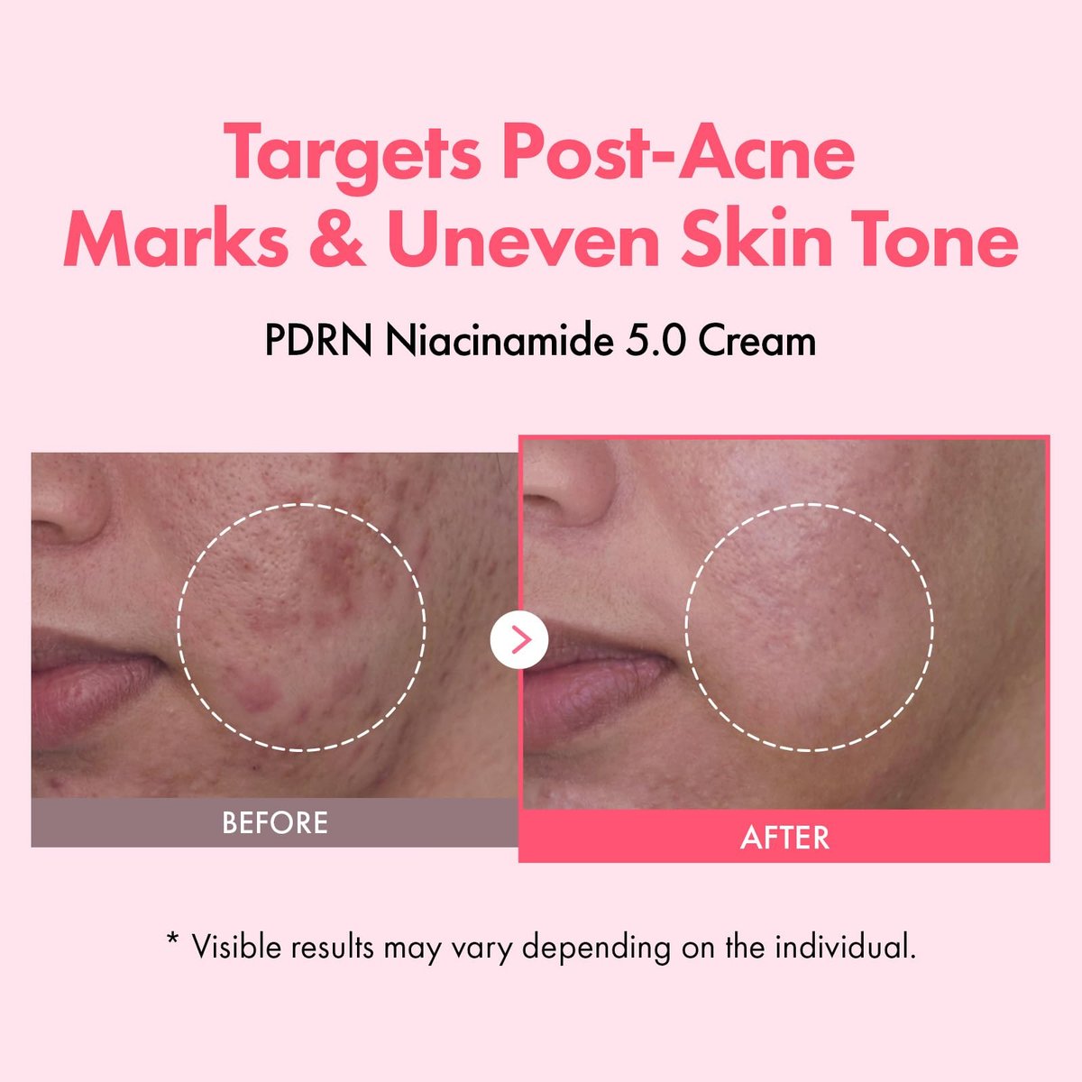 TOSOWOONG PDRN Niacinamide 5.0 Cream – Dark Spot Remover & Hydrating Moisturizer with Salmon DNA, Korean Skincare 50ml Avelisse