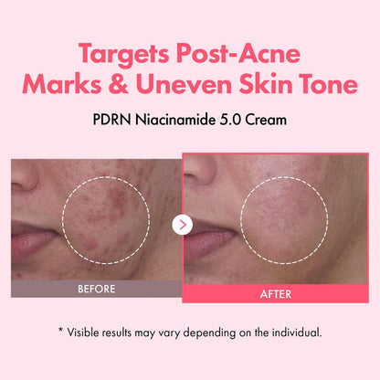 TOSOWOONG PDRN Niacinamide 5.0 Cream – Dark Spot Remover & Hydrating Moisturizer with Salmon DNA, Korean Skincare 50ml Avelisse