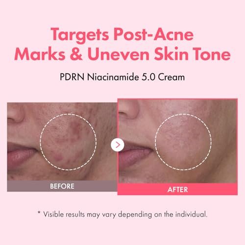 TOSOWOONG PDRN Niacinamide 5.0 Cream – Dark Spot Remover & Hydrating Moisturizer with Salmon DNA, Korean Skincare 50ml Avelisse