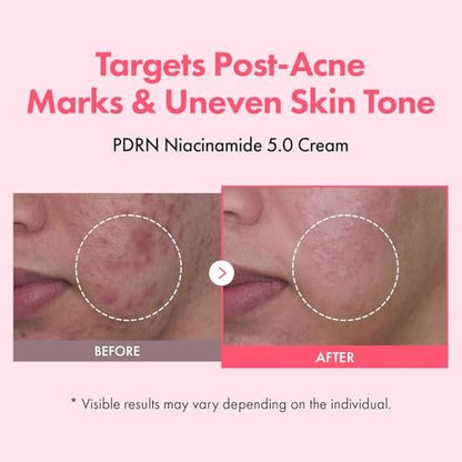 TOSOWOONG PDRN Niacinamide 5.0 Cream – Dark Spot Remover & Hydrating Moisturizer with Salmon DNA, Korean Skincare 50ml Avelisse