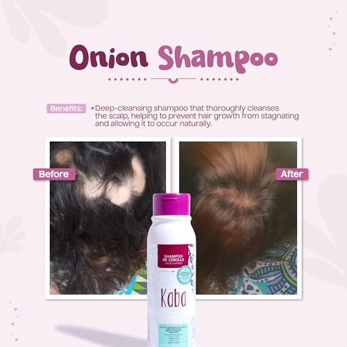 Kaba Onion Shampoo for Hair Growth - Sulfate-Free & Paraben-Free - Stimulates Hair Regrowth, Reduces Hair Loss, Deep Scalp Cleanse for All Hair Types - 500 ML Avelisse