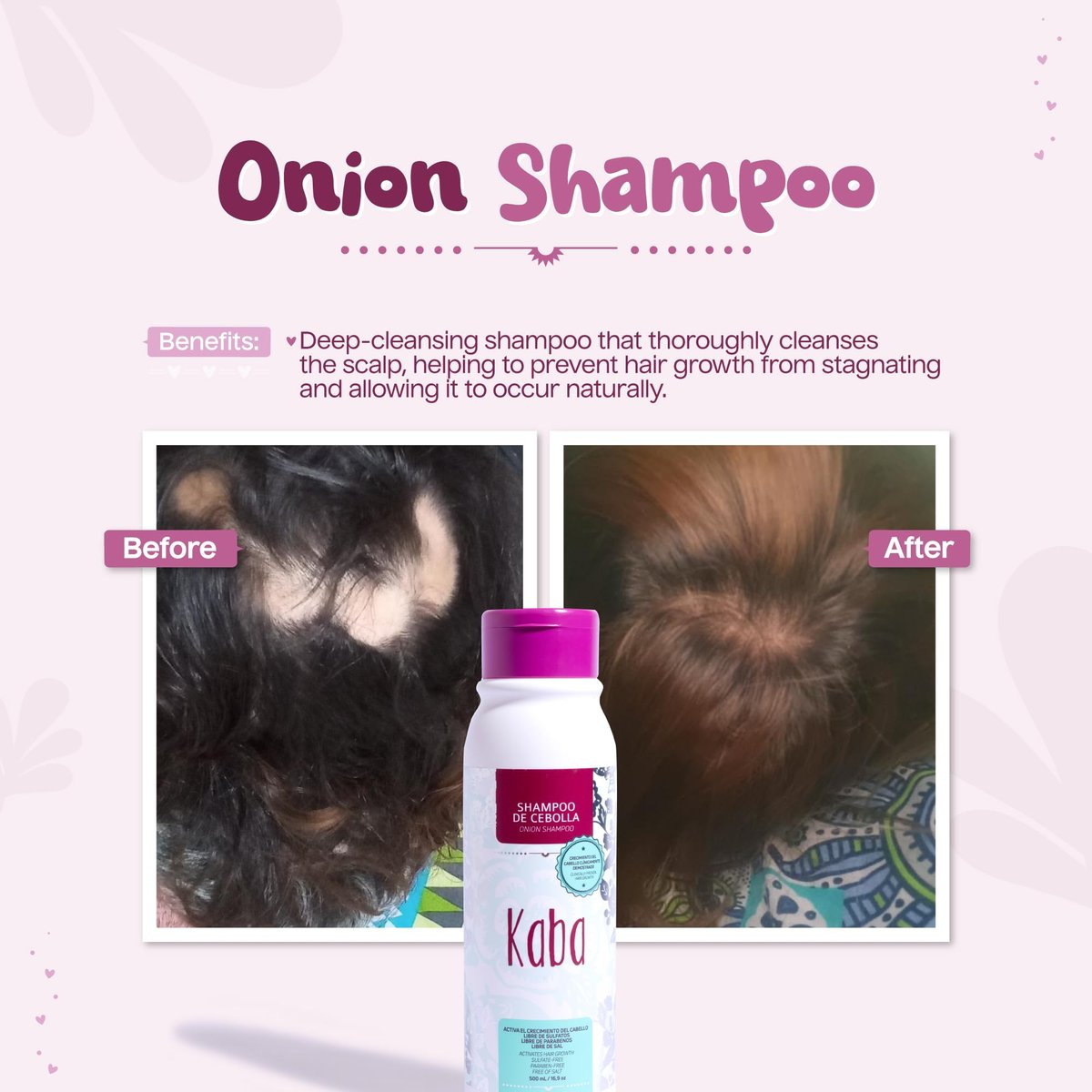Kaba Onion Shampoo for Hair Growth - Sulfate-Free & Paraben-Free - Stimulates Hair Regrowth, Reduces Hair Loss, Deep Scalp Cleanse for All Hair Types - 500 ML Avelisse