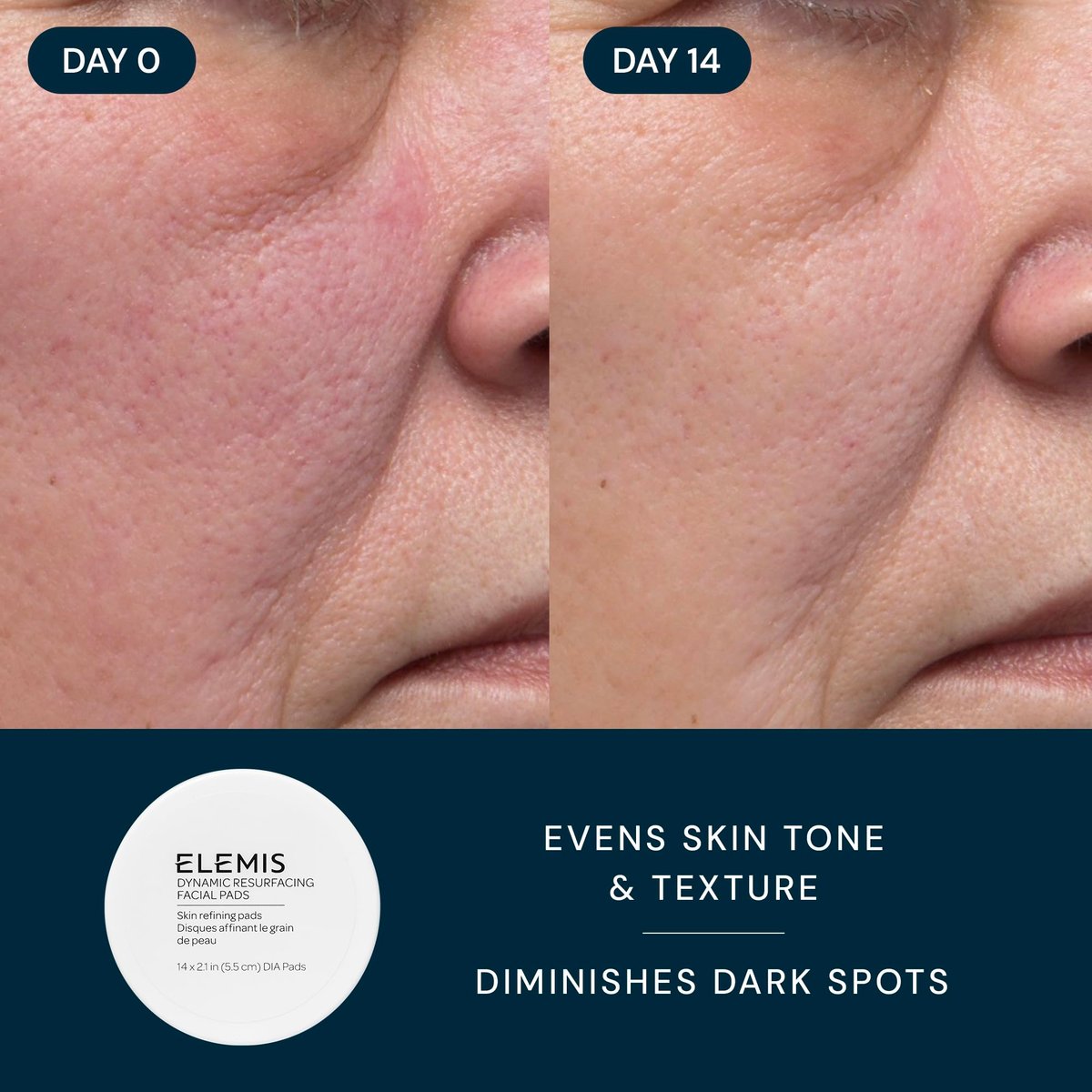 ELEMIS Healthy Skin Exclusive Travel Set - Pro-Collagen Cleansing Balm, Marine Cream SPF 30 & Dynamic Resurfacing Pads - Anti-Aging Hydrating Skincare Travel Kit Avelisse