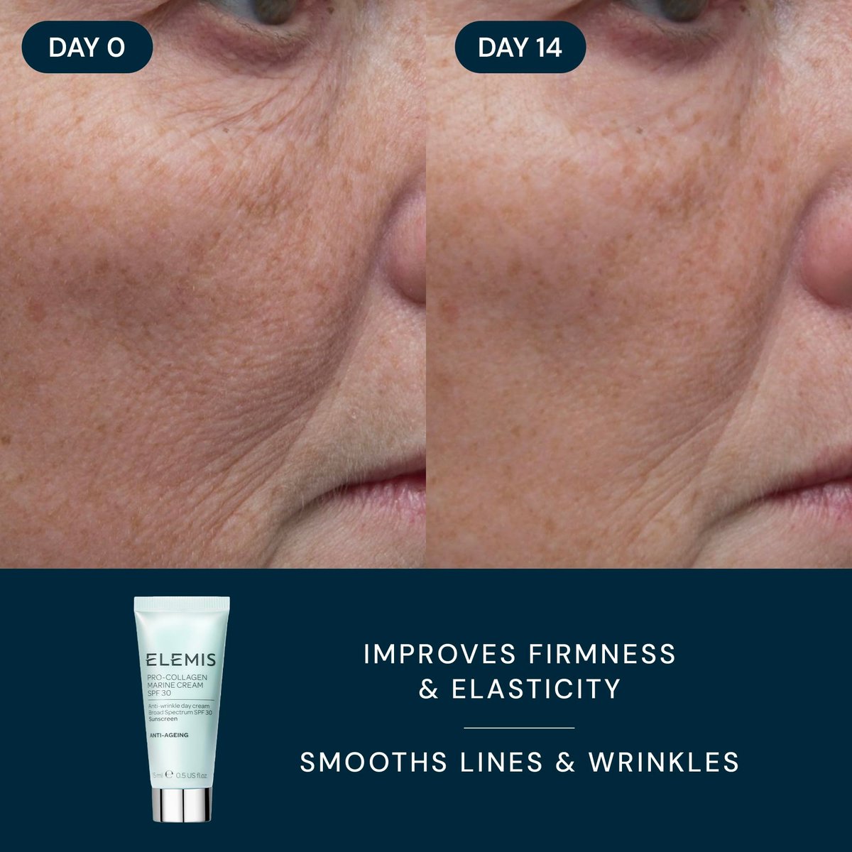 ELEMIS Healthy Skin Exclusive Travel Set - Pro-Collagen Cleansing Balm, Marine Cream SPF 30 & Dynamic Resurfacing Pads - Anti-Aging Hydrating Skincare Travel Kit Avelisse