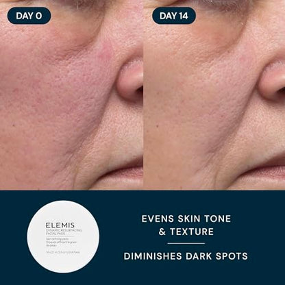 ELEMIS Healthy Skin Exclusive Travel Set - Pro-Collagen Cleansing Balm, Marine Cream SPF 30 & Dynamic Resurfacing Pads - Anti-Aging Hydrating Skincare Travel Kit Avelisse