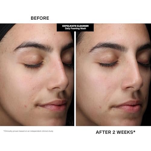 Kate Somerville Pore-fect Skin Edit Travel Kit: ExfoliKate, EradiKate & Goat Milk Cleanser Holiday Gift Set Avelisse