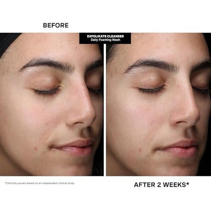 Kate Somerville Pore-fect Skin Edit Travel Kit: ExfoliKate, EradiKate & Goat Milk Cleanser Holiday Gift Set Avelisse