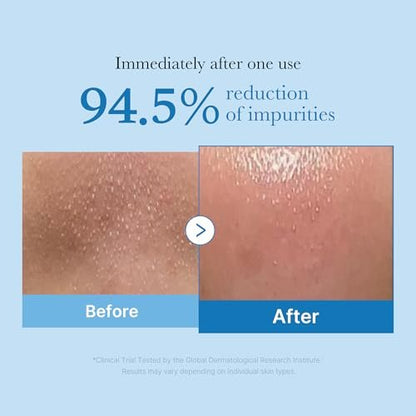 medicube Zero Pore Blackhead Cleansing Oil - Makeup Remover & Daily Moisture Facial Cleanser for All Skin Types, Low-Irritation Korean Skin Care (205ml / 6.93 fl.oz) Avelisse