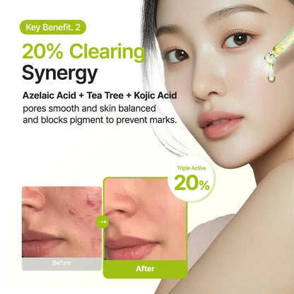 PURITO Azelaic Acid 10% + Kojic Acid + Tea Tree Facial Serum - Blemish-Prone Skin Korean Skincare, 30mL (1.01 fl.oz) Avelisse