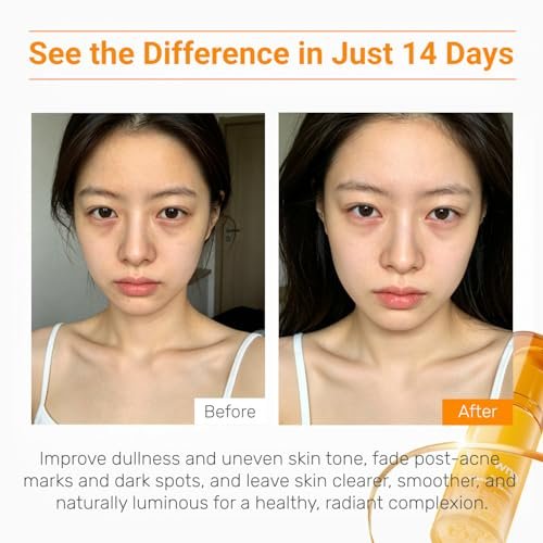 WNP Vitamin C Serum for Face – Anti-Aging & Brightening Serum with Hyaluronic Acid & Vitamin E, Dermatologist Tested for Dark Spots, Melasma, Hyperpigmentation, Fine Lines & Wrinkles (30ml) Avelisse