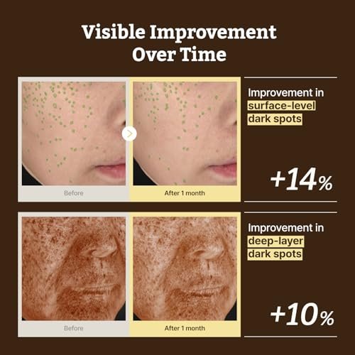 Dr.Reju-All Advanced Retino-Mela Serum – HPR Retinol Serum for Face – Anti-Aging, Pore Minimizer – Next-Gen Korean Skincare – Gentle & Beginner-Friendly – Niacinamide 10% & TXA 4% – 1 Fl Oz Avelisse