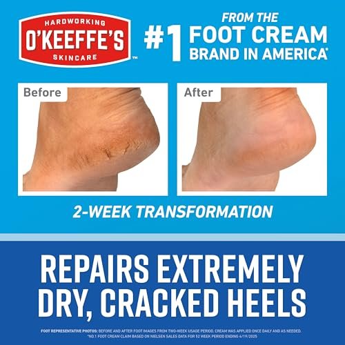 O'Keeffe's for Healthy Feet Heel Repair Kit – Reusable Foot Sleeves & Intense Renewal Foot Cream with Urea & Lactic Acid, Exfoliates & Softens Dry Heels Avelisse