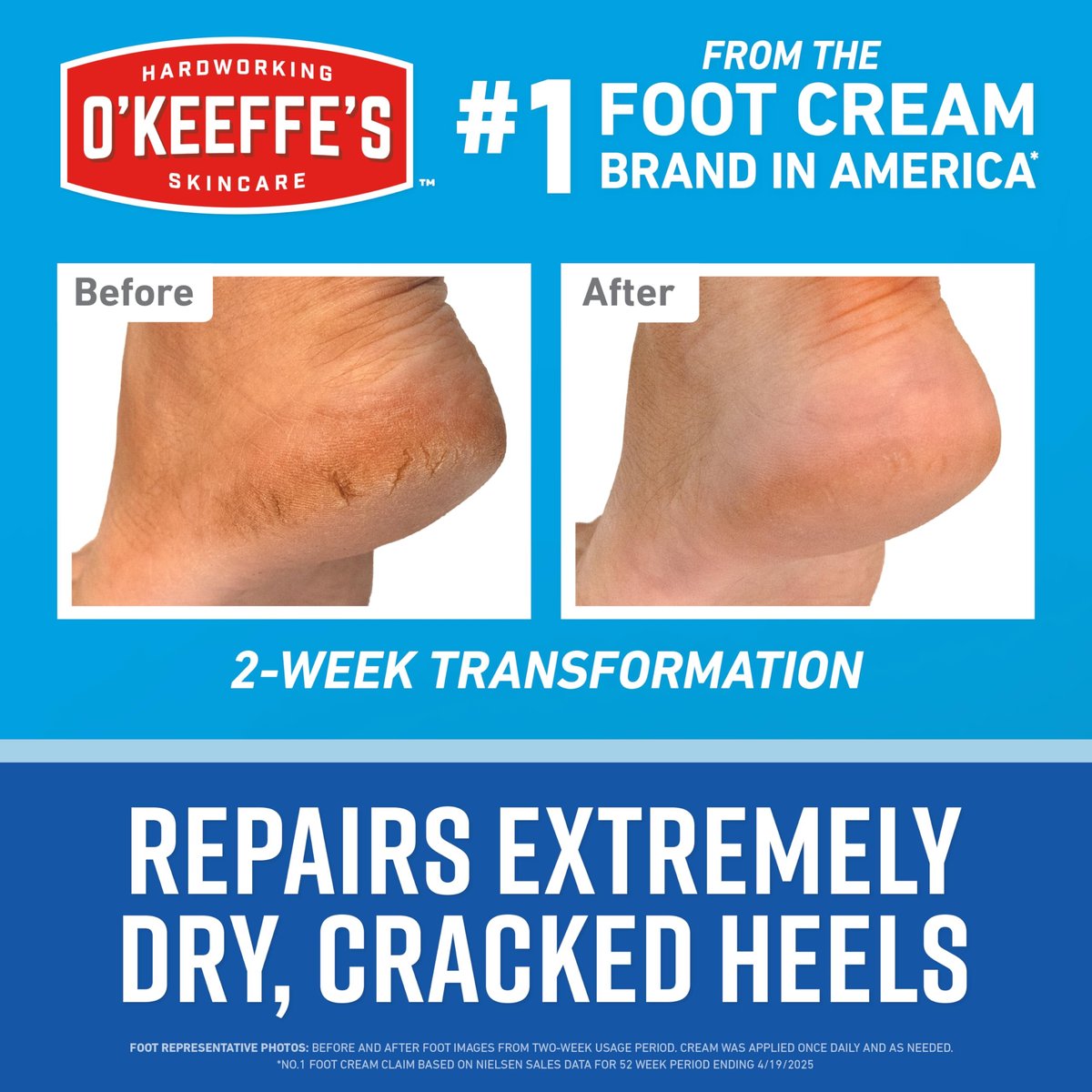 O'Keeffe's for Healthy Feet Heel Repair Kit – Reusable Foot Sleeves & Intense Renewal Foot Cream with Urea & Lactic Acid, Exfoliates & Softens Dry Heels Avelisse