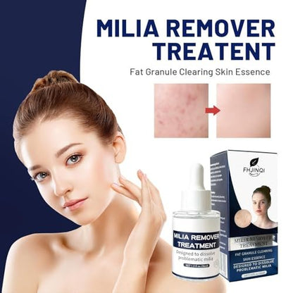 Milia Remover Treatment for Face & Eyes - Salicylic Acid Serum for Fat Granule Clearing, Acne Spot Treatment, Skin Smoothing Essence (1 Fl Oz) Avelisse