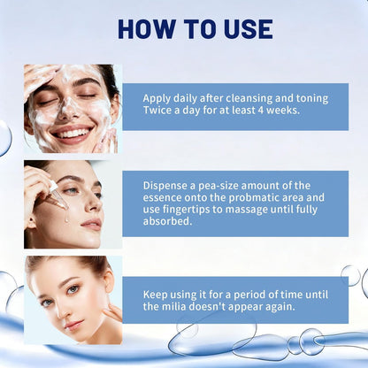 Milia Remover Treatment for Face & Eyes - Salicylic Acid Serum for Fat Granule Clearing, Acne Spot Treatment, Skin Smoothing Essence (1 Fl Oz) Avelisse