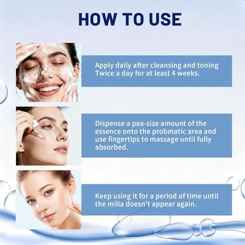 Milia Remover Treatment for Face & Eyes - Salicylic Acid Serum for Fat Granule Clearing, Acne Spot Treatment, Skin Smoothing Essence (1 Fl Oz) Avelisse