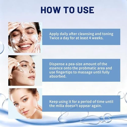 Milia Remover Treatment for Face & Eyes - Salicylic Acid Serum for Fat Granule Clearing, Acne Spot Treatment, Skin Smoothing Essence (1 Fl Oz) Avelisse