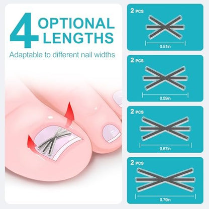 VITASY Ingrown Toenail Treatment Kit – Upgraded 6-Angle Shape Titanium Alloy Corrector with 4 Multi-Size Strips for Curved Toenail Quick Relief (8 Pieces, Silver) Avelisse