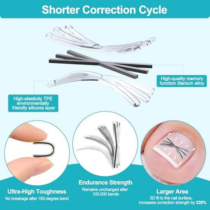 VITASY Ingrown Toenail Treatment Kit – Upgraded 6-Angle Shape Titanium Alloy Corrector with 4 Multi-Size Strips for Curved Toenail Quick Relief (8 Pieces, Silver) Avelisse