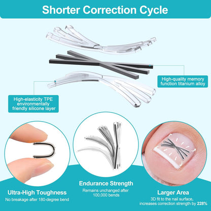 VITASY Ingrown Toenail Treatment Kit – Upgraded 6-Angle Shape Titanium Alloy Corrector with 4 Multi-Size Strips for Curved Toenail Quick Relief (8 Pieces, Silver) Avelisse