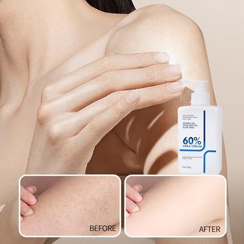 NIZENTA Urea Cream 60% Body Lotion 10.58 Oz – Intense Moisturizer for Extremely Dry Skin, Non-Greasy Formula - görsel 7
