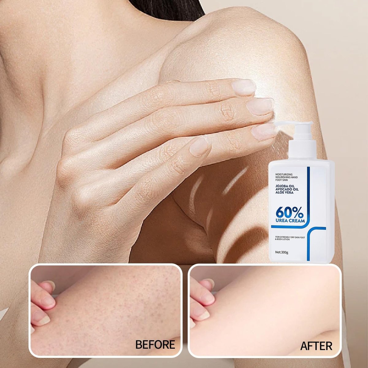 NIZENTA Urea Cream 60% Body Lotion 10.58 Oz – Intense Moisturizer for Extremely Dry Skin, Non-Greasy Formula - görsel 8
